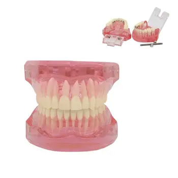Zubné Štandard 1:1 Typodont Zuby Model Ortodontická Demo Zuby Model s Neviditeľné Kovový Držiak M3004